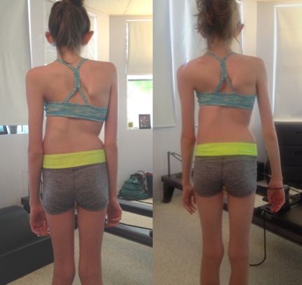 pilates before and after