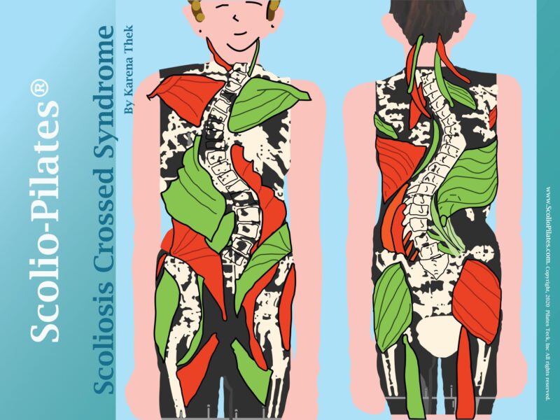 Muscle Imbalance And Scoliosis The Unexpected Connection - nn8ke8i