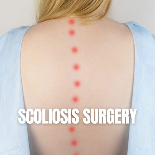 Back view of a person in a hospital gown with a dotted red line marking the spine, "Scoliosis Surgery" text overlaid.