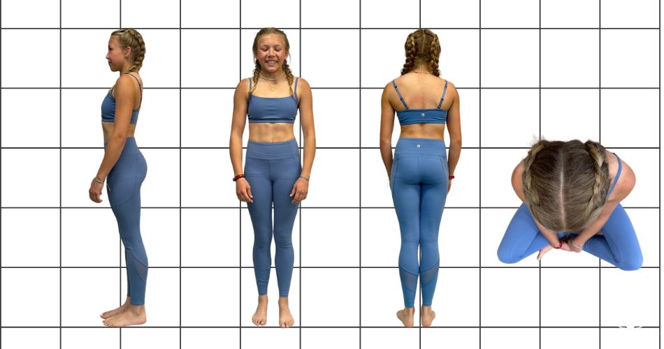 Side, front, back, and top-down views of a young woman against a posture grid, showing the three planes used in scoliosis assessment