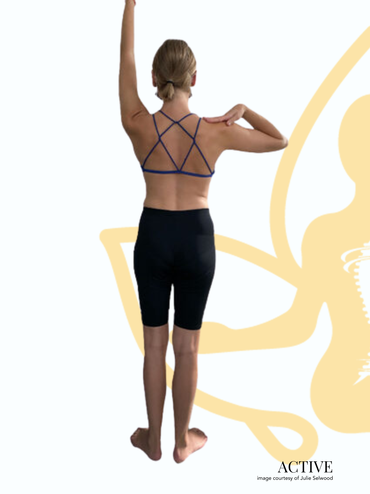 Before and after posture change with Scolio-Pilates, image courtesy of Julie Selwood